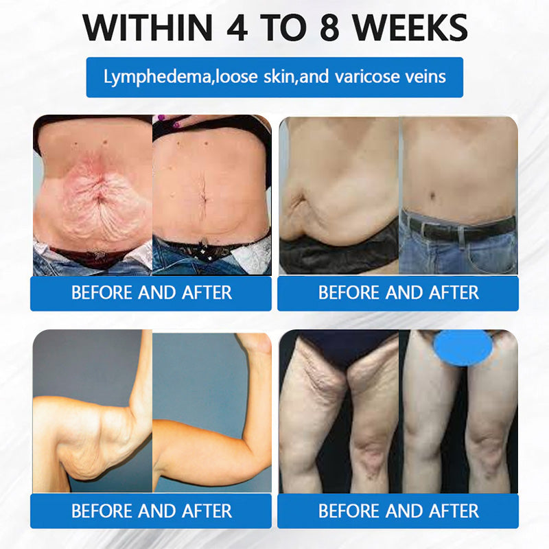 🔥 Best Seller-TirzaForm® SMGT-GLP-1 𝐓𝐢𝐫𝐳𝐞𝐩𝐚𝐭𝐢𝐝𝐞 & 𝐂𝐨𝐥𝐥𝐚𝐠𝐞𝐧 𝐍𝐚𝐧𝐨 𝐌𝐢𝐜𝐫𝐨𝐧𝐞𝐞𝐝𝐥𝐞 𝐖𝐞𝐢𝐠𝐡𝐭 𝐋𝐨𝐬𝐬 𝐏𝐚𝐭𝐜𝐡丨Total Body Wellness: Burn Fat, Balance Blood Sugar, Tighten Skin, Boost Energy