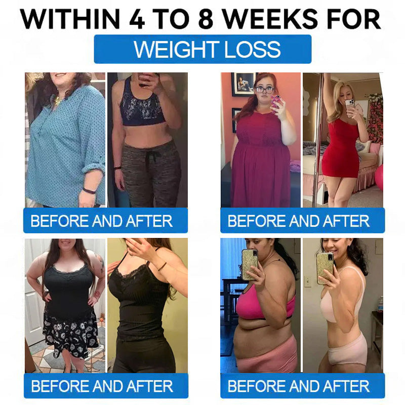 🔥 Best Seller-TirzaForm® SMGT-GLP-1 𝐓𝐢𝐫𝐳𝐞𝐩𝐚𝐭𝐢𝐝𝐞 & 𝐂𝐨𝐥𝐥𝐚𝐠𝐞𝐧 𝐍𝐚𝐧𝐨 𝐌𝐢𝐜𝐫𝐨𝐧𝐞𝐞𝐝𝐥𝐞 𝐖𝐞𝐢𝐠𝐡𝐭 𝐋𝐨𝐬𝐬 𝐏𝐚𝐭𝐜𝐡丨Total Body Wellness: Burn Fat, Balance Blood Sugar, Tighten Skin, Boost Energy