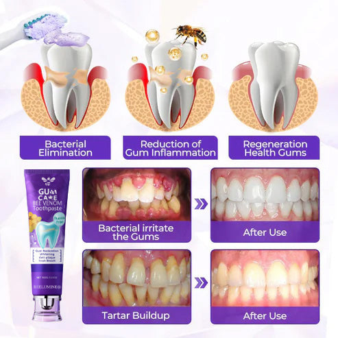 BeeLumine® BeeRenew — Clinically Advanced Regenerative Gum Therapy