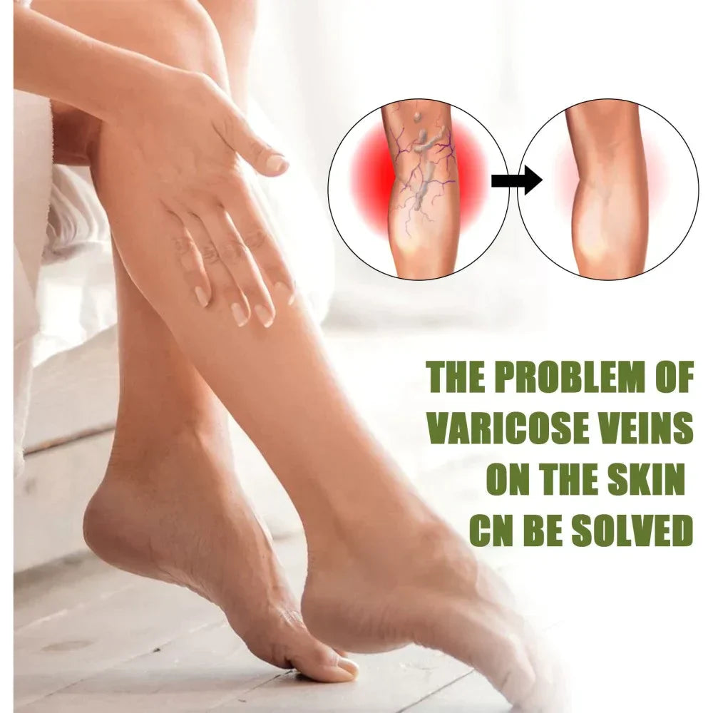 🔥Varellix™ Sale Varicose Veins Relief Spray – Herbal Treatment For Spider & Varicose Veins - 94% Of Users See Visible Results Within 1 To 2 Weeks!🔥