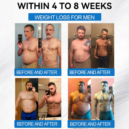 🔥 Best Seller-TirzaForm® SMGT-GLP-1 𝐓𝐢𝐫𝐳𝐞𝐩𝐚𝐭𝐢𝐝𝐞 & 𝐂𝐨𝐥𝐥𝐚𝐠𝐞𝐧 𝐍𝐚𝐧𝐨 𝐌𝐢𝐜𝐫𝐨𝐧𝐞𝐞𝐝𝐥𝐞 𝐖𝐞𝐢𝐠𝐡𝐭 𝐋𝐨𝐬𝐬 𝐏𝐚𝐭𝐜𝐡