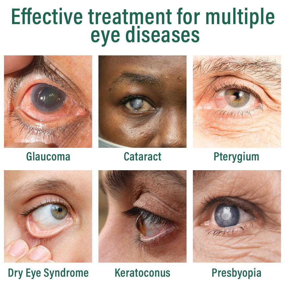 👩‍⚕️Ourlyard® Nano Eye Drops Serum ✅FDA Approved(Suitable for presbyopia, dry eye syndrome, glaucoma, and cataracts) ☘️☘️