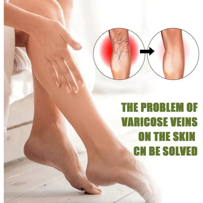 🔥Varellix™ Sale Varicose Veins Relief Spray – Herbal Treatment For Spider & Varicose Veins - 94% Of Users See Visible Results Within 1 To 2 Weeks!