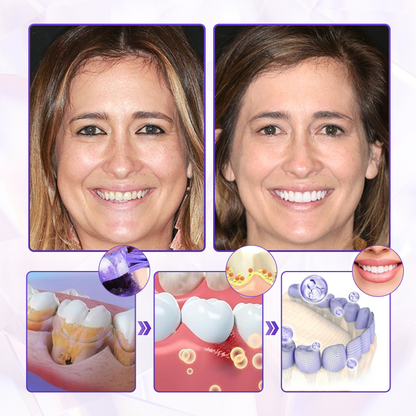 BeeLumine® BeeRenew — Clinically Advanced Regenerative Gum Therapy（2）