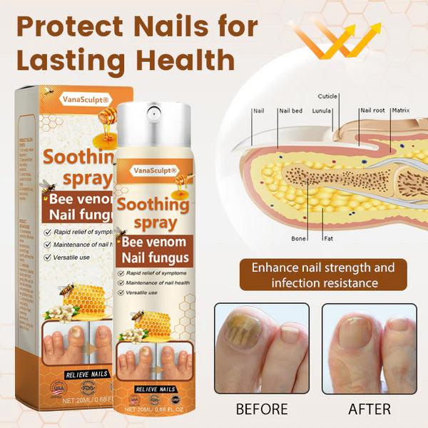 VanaSculpt® Bienenvergiftung Nagelpilz Spray