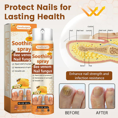 VanaSculpt® Bienenvergiftung Nagelpilz Spray